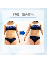 ルミナ ビューティーアンドリラックス(LUMINA Beauty&Relax)/部分ケアもお任せください☆