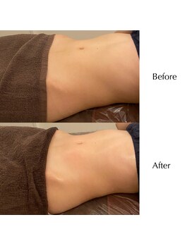 ラピスビューティーサロン(Lapis beauty salon)/ダイエットを更に加速！