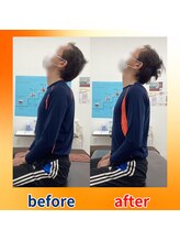 ストレッチヒーロー 福山神辺店/ビフォーアフター【1回の変化】