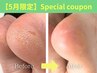 【5月限定】フット／足裏角質ケア＋シェラックワンカラー　14850→12850円