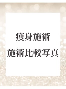 ドレス(dress)/痩身施術比較写真
