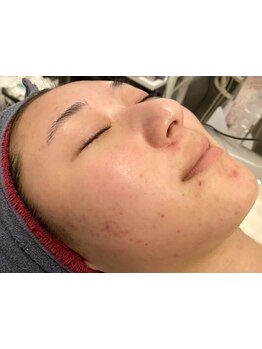 お肌をきれいにしたい