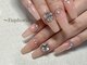 ユーフォリア(Euphoria)の写真/【1本～長さだしOK】深爪/亀裂補強/自爪が折れやすい・薄いetc自爪の形にとらわれず理想の指先を叶えます★