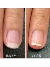 ネイルズ アヴァンティ(Nails Avanti)/自爪育成ネイルケア