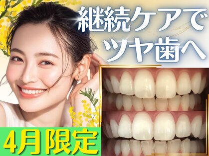 LBSホワイトニング 新宿店の写真