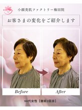 小顔美肌ファクトリー 梅田院/
