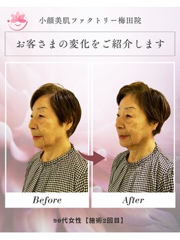 小顔美肌ファクトリー 梅田院/
