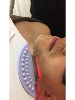 サロンドスズカ(SalondeSuzuka)/メンズ脱毛 ひげ丸ごと