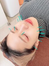 ヒーリングサロン アージュ(A-je)/★美顔鍼＋小顔矯正★