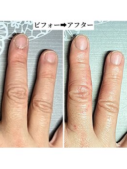 爪はゆっくり変わります