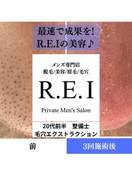 レイ(R.E.I)/毛穴エクストラクション／3回