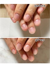ネイルサロンアンドスクールラボ(LABO)/深爪を数回で、通常の長さに☆