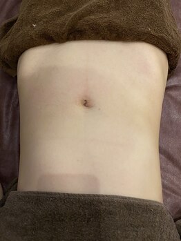 サロンモリ(Salon Mori)/ハンドオイルマッサージで腸活