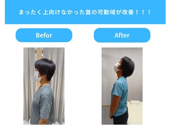 きくち整骨院/上を向けるようになりました