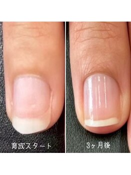 自爪育成ネイルケア