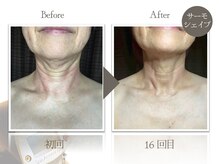 ビューティーリバース 二俣川店/★劇的ビフォーアフター★