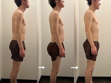 ヴィセラ(Vicella)/腰痛が楽になる！