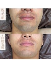 ルトゥール(Retour)/メンズ　ヒゲ