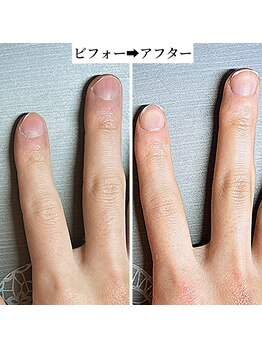 桃の木 吉祥寺店/ネイルケア1回で変わって見える