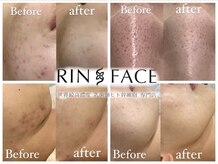 リンフェイス 池袋店(RIN FACE)