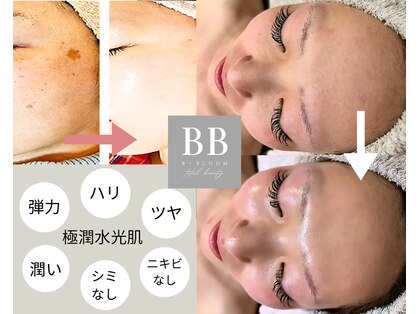 ビー ブルーム(B BLOOM)の写真