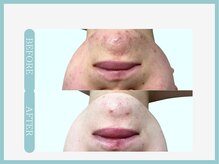 スリムライン 秋田店(The Slim Line)/before→after