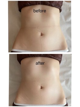 エステアンドネイルサロン ぶらんぶりえ/