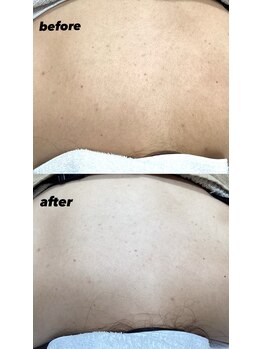 ヨシザワインク バンダイ(YOSHIZAWA Inc. BANDAI)/背中　Before After