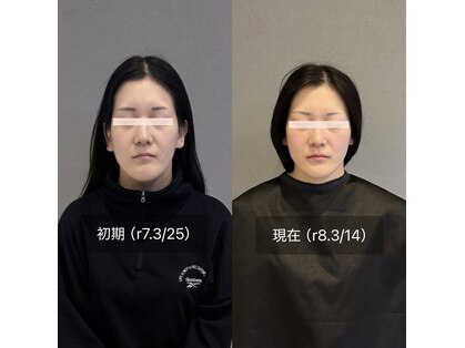 プライミー(PRIMY)の写真