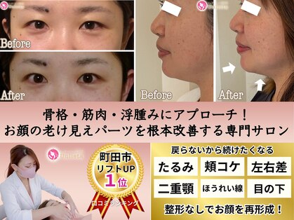 アンリエッタ(Unlieta)の写真