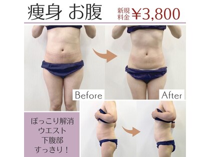 ペルラペティーユ(PERLA PETILLER)の写真