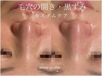 SALON DE Cの写真/SALON DE C式肌管理！【世界基準トリートメント×韓国肌管理×ハーブピーリング　初回18800円】
