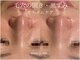 SALON DE Cの写真/SALON DE C式肌管理！【世界基準トリートメント×韓国肌管理×ハーブピーリング　初回18800円】