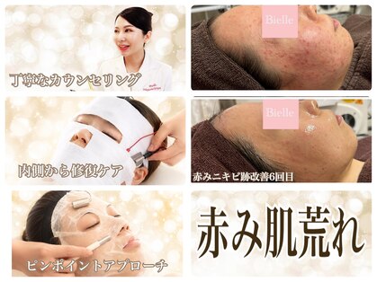 ビエル(Bielle)の写真