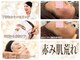 ビエル(Bielle)の写真