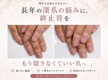アウェイク(Awake)