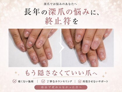 アウェイク(Awake)の写真
