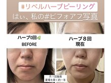 ルキア(LUKIA)/オーナーの凸凹肌もリベルで激変