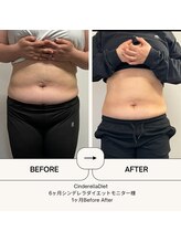 オーシャン整骨院(OCEAN整骨院)/ダイエット６ヶ月コース