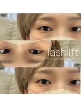 エル 薬院店(Eru)/リフトアップ効果♪