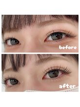 ジープラス(G+)/エクパー