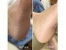 【足裏フットケア★】ガサガサな足裏をつるつるに！角質除去コース　¥2,000