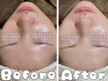 グラシア 倉敷店(Gracia)/お客様の施術事例