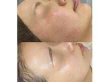 チェルト 鈴鹿店(CERTO)の雰囲気（内側からお肌を整え、ゆで卵の様なちゅるんとツヤ肌に♪♪）