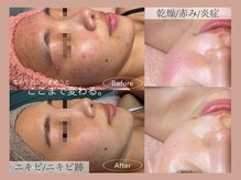 ビューティーサロンリア 栄 伏見店(LI'A)
