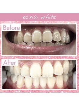 エクシアホワイト 長野店/