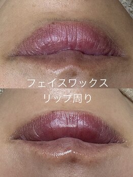 フェリシダージ(felicidade)/顔脱毛/フェイスワックス