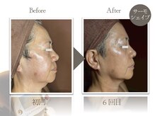 ビューティーリバース 二俣川店/★劇的ビフォーアフター★