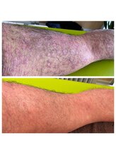 シラカワ 小倉院(SHIRAKAWA)/肌トラブルにも相性抜群◎