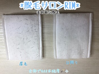 リム 横浜(RIM)/小鼻脱毛